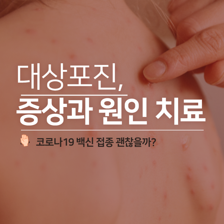 대상포진 걸렸을때 증상과 원인 치료법, 코로나 백신 접종은?