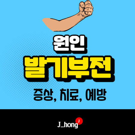  발기부전이란? 원인, 증상, 치료, 예방 정리