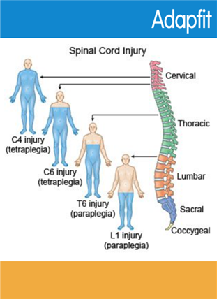 SCI, Spinal Cord Injury 특징 척수손상 헬스장 운동 방법 함께 알아봐요