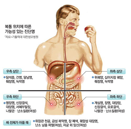  복막염 원인병태생리 대표증상징후 진단검사치료 간호중재 합병증사망률예후 복부통증부위 간호케이스문헌고찰