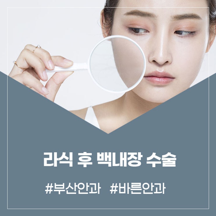  라식 후 백내장 수술: 알아야 할 사항