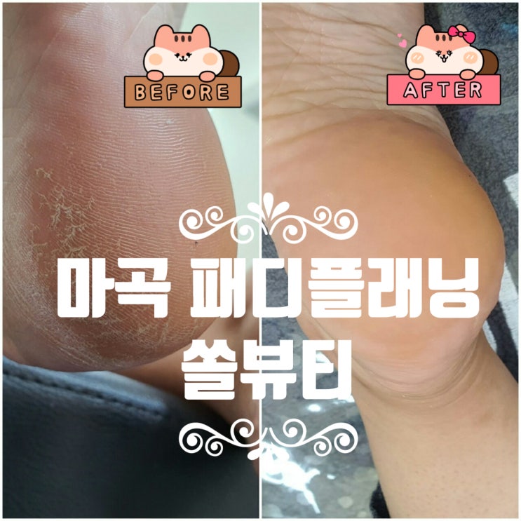  마곡 패디플래닝 [쏠뷰티]에서 발각질제거로 뽀송뽀송한 발 만들기! :)