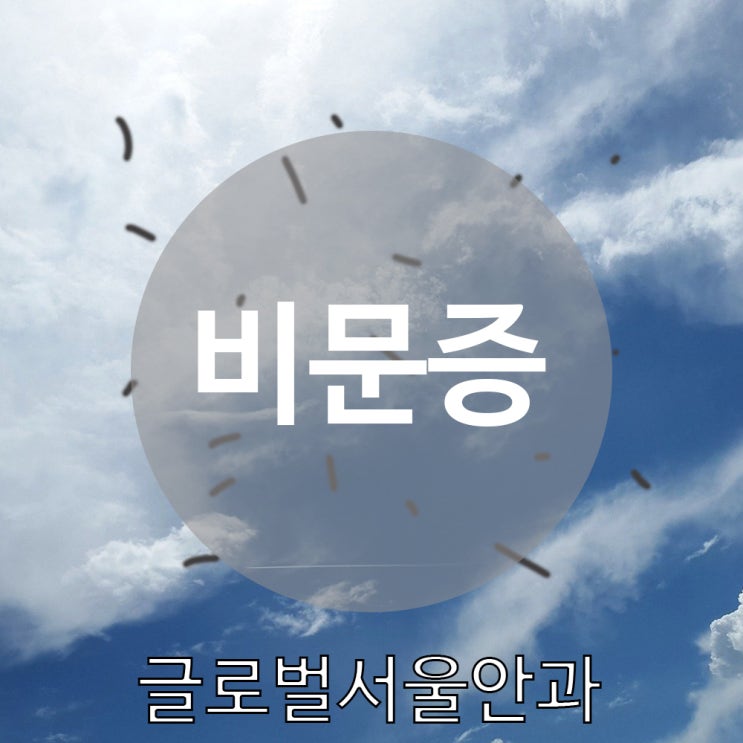 강남안과 비문증이란 무엇인가? 강남안과 비문증이란 무엇인가?