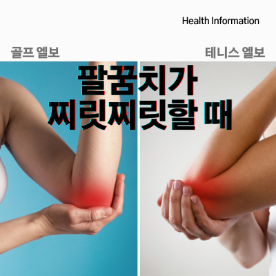  팔꿈치가 찌릿찌릿할 때_골프엘보 테니스엘보