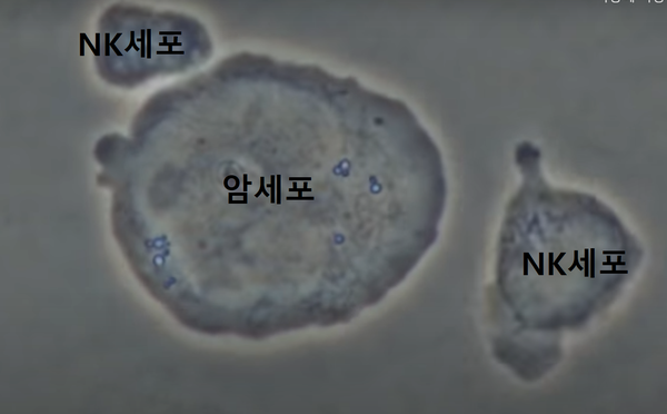  면역핵심 NKCELL 건강하게 높이는 운동