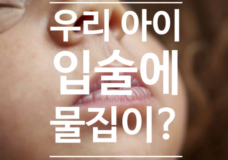 지식인 상담소) 우리 아이 입술에 물집이 생긴 것 같아요? 아기 입술 물집 현상? 지식인 상담소) 우리 아이 입술에 물집이 생긴 것 같아요? 아기 입술 물집 현상?