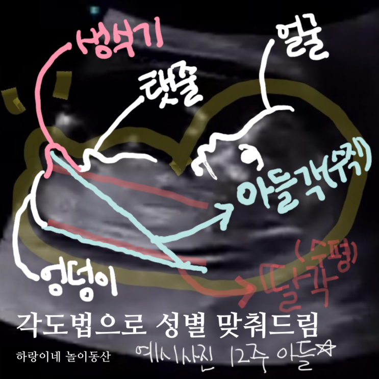  임신 12주 성별 각도법 초음파사진으로 아들 딸 판독해드림