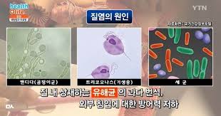  여성질염 원인증상특징 5가지질염종류 산부인과진단검사 항생제치료 냉대하분비물 가려움증 악취비린내