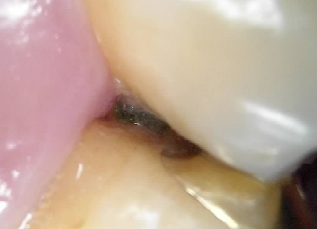  복대동치과 어떻게 선택해야할까요? 광고 보기 싫으신 분들만 확인해주세요.