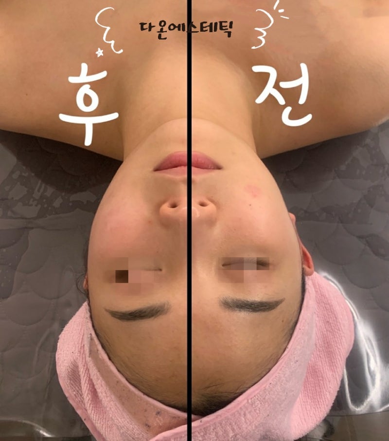 아름답고 건강한 몸을 위한 잠실스킨케어 아름답고 건강한 몸을 위한 잠실스킨케어