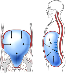  뇌성마비/정상발달 설명해주는 남자 - 복강내압(intra abdominal pressure, IAP란)
