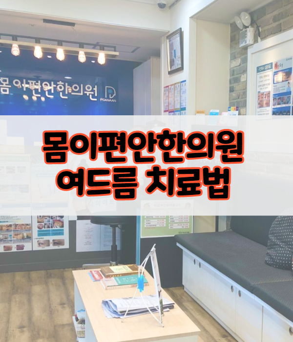 신도림여드름한의원 피부과 치료 흉터도
