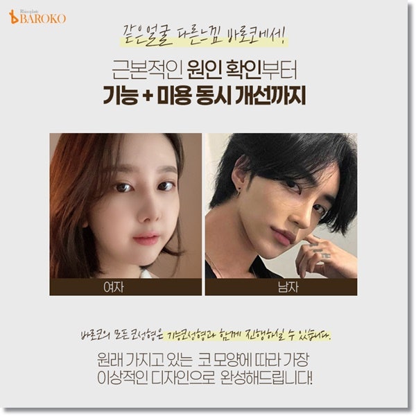 기능코성형비용 가격 부담 덜면서