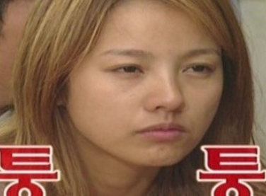  입술부어오름증상 빠르게 완화시키는 방법