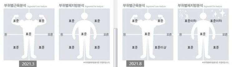  내돈내산 바디인모드 2차 2주 후 후기(팔뚝, 부유방, 복부)