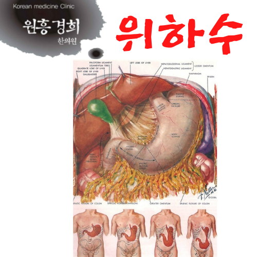  위하수(胃下垂)