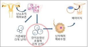 [신건강법 특집]-<시험관 아기와 미혼모 아기>