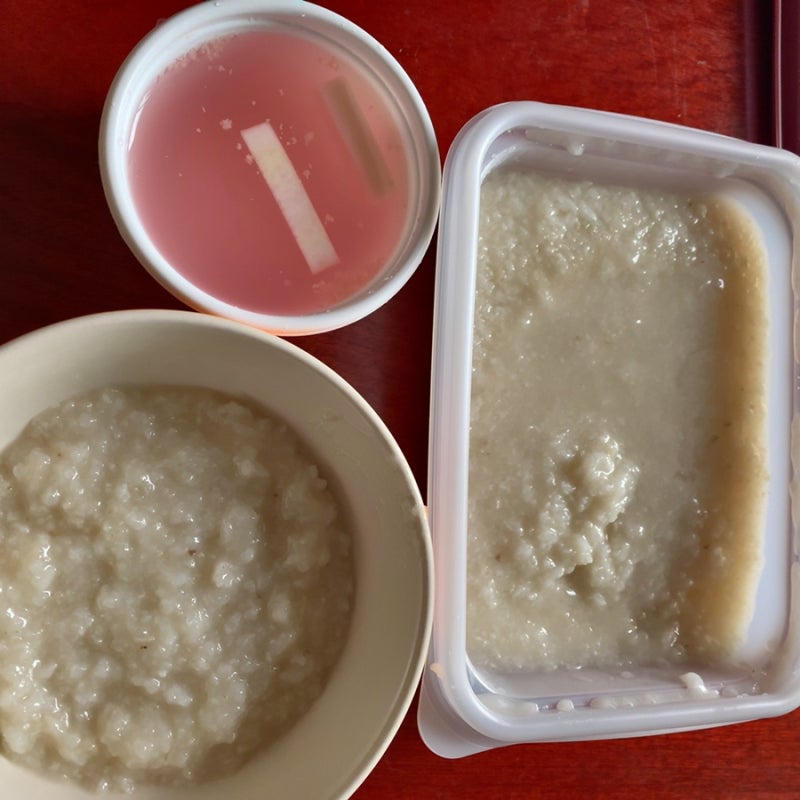 편도제거수술 편도절제술 후기_당일~5일차(+음식 기록)