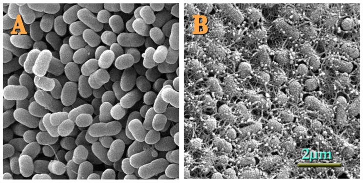  햄버거병을 일으키는 대장균 E. coli O157:H7
