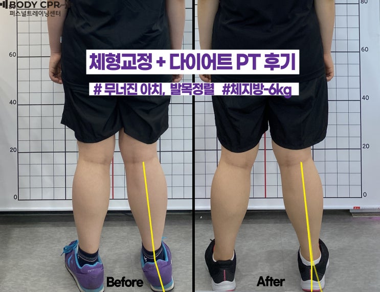  노원PT 체형교정(발목 재정렬) + 체중감량-6kg 회원님 후기.중계동PT
