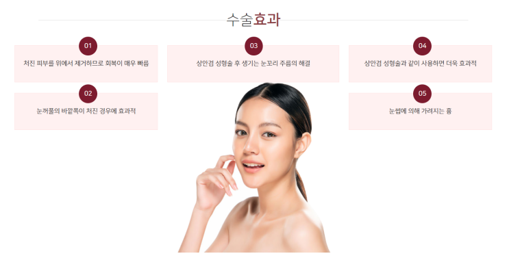  상안검 주름성형