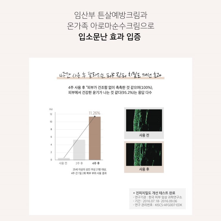  임산부튼살크림 튼살 고민 해결 제품 추천