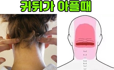 귀뒤통증(왼쪽 오른쪽) 찌릿찌릿 머리가 깨질듯 아파요. : 네이버 블로그