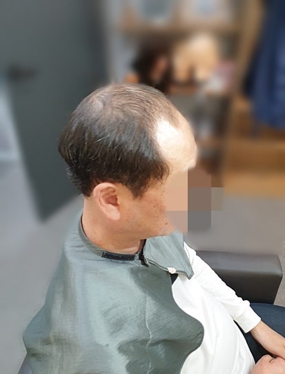 대구 남자 가발 가발댄스에서 눈에 띄지 않게 맞춤으로 해주세요. 2