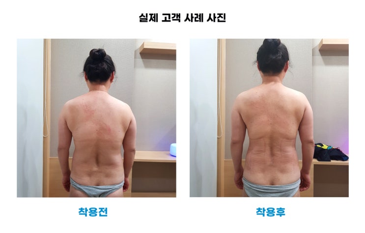  허리통증과 20년간 심했던 생리통 완화: 바른자세 교정사례 01