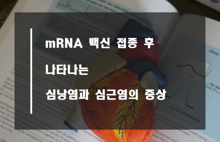  mRNA 백신 접종 후 심낭염과 심근염 증상