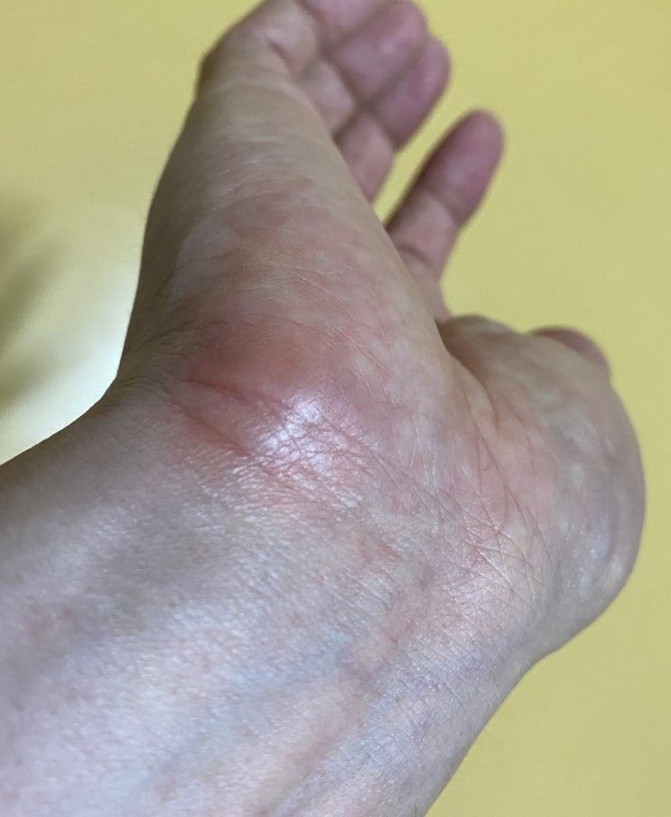 손목과 뼈 보호 마우스 패드 구매 전 확인사항. 안 하면 폭망 손목과 뼈 보호 마우스 패드 구매 전 확인사항. 안 하면 폭망
