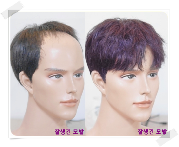  투블럭가발 심는 남자맞춤업체에서 당일 제작 가격비용은