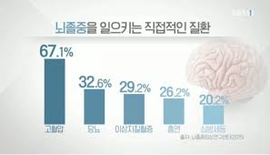  경막외뇌출혈EDH 원인증상징후 출혈부위특징 진단검사치료 예후경과합병증 뇌출혈종류 간호진단과정