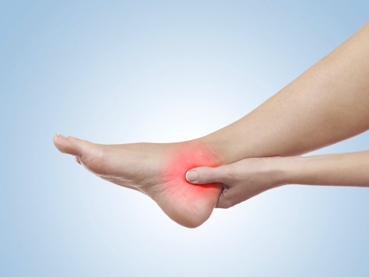 발목 안쪽 통증, 자칫 치료 미루다가 평발 된다?