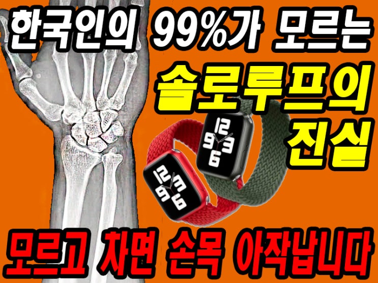 스마트워치 솔로루프 모르고 차면 손목 아직 납니다!!