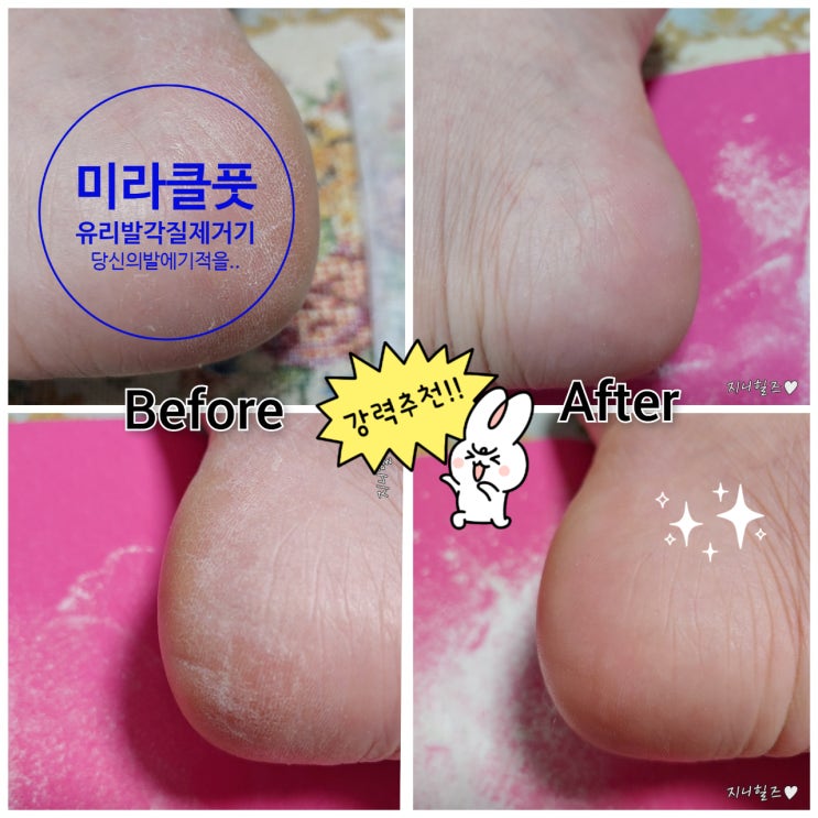  발각질제거 완결판!!! [ 미라클풋 ] 유리발각질제거기이건 꼭 사야해~~ 찐후기보고가세요^^