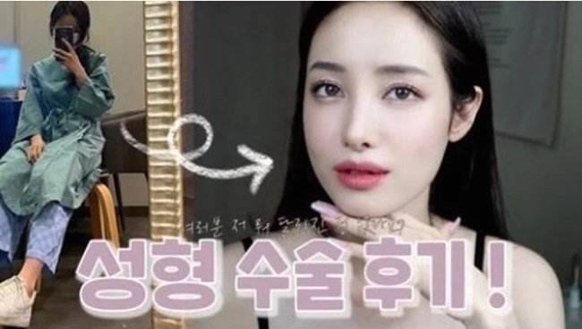  유깻잎 가슴 수술 고백 얼굴 지방이식 후기
