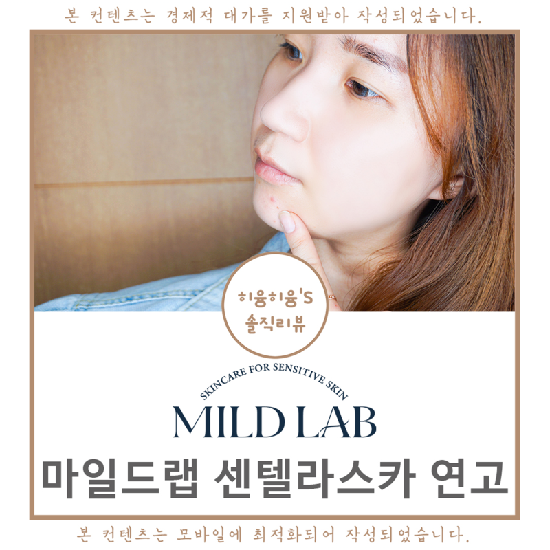 좁쌀 여드름 없애는 센텔라스카 연고가 진리! 5