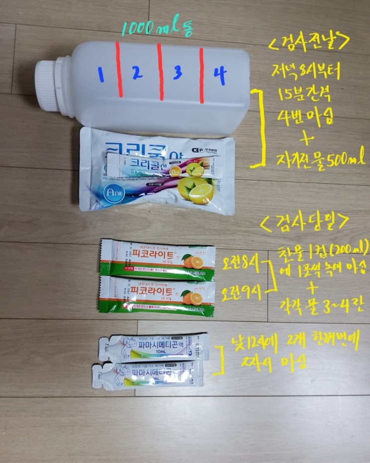  대장내시경 검사