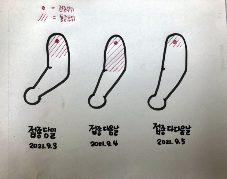  30대 화이자 백신 1차 후기 통증 감정기복 무기력