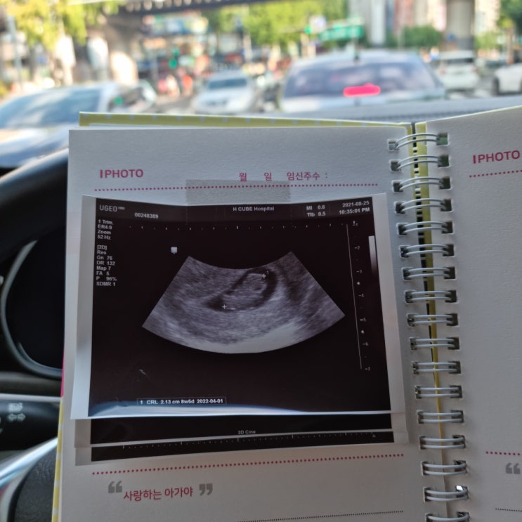 임신초기증상 ~ 임신 9주차 증상과 주차별 초음파 사진