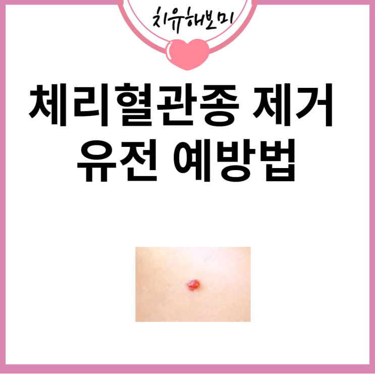 체리혈관종 제거와 유전 예방법
