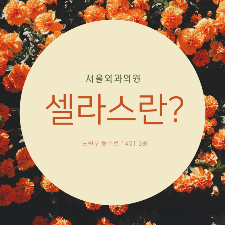  노원역피부과 셀라스가 뭐예요?