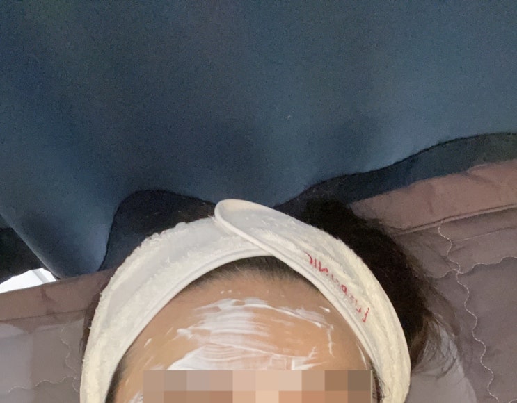  여드름치료일기no.4/혈관레이저 포함 3가지 믹스치료/색소침착/미노씬 줄이는 중