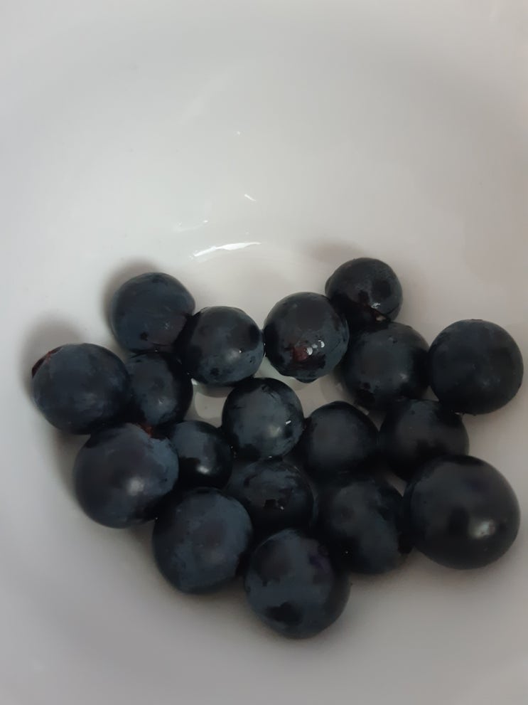  치질수술 pph 37일차 일상
