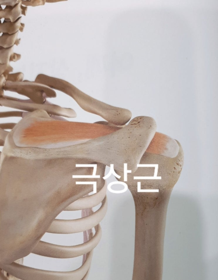  석회성 건염, 극상근