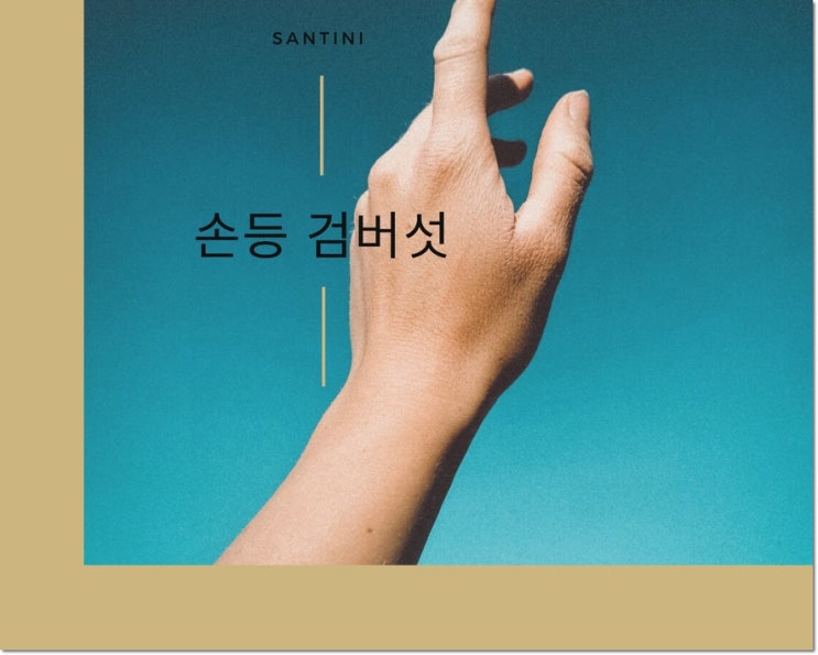 손등검버섯 원인 스트레스 나에게도 ? 손등검버섯 원인 스트레스 나에게도 ?