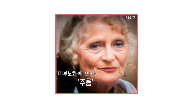 피부노화가 진행되며 생기는 주름 l 원인, 원리, 제어수단, 개선 성분