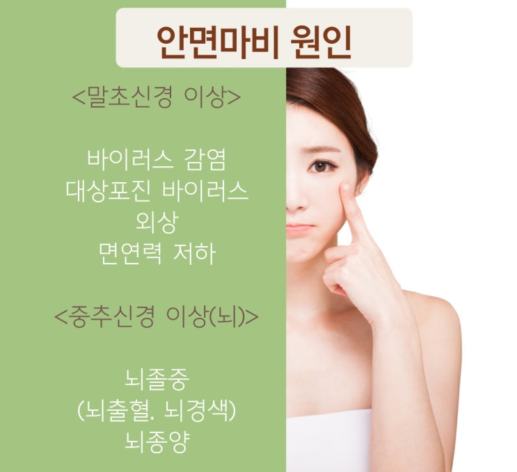  구안와사 병원 안면마비 벨마비 증상과 치료법 알려드립니다.