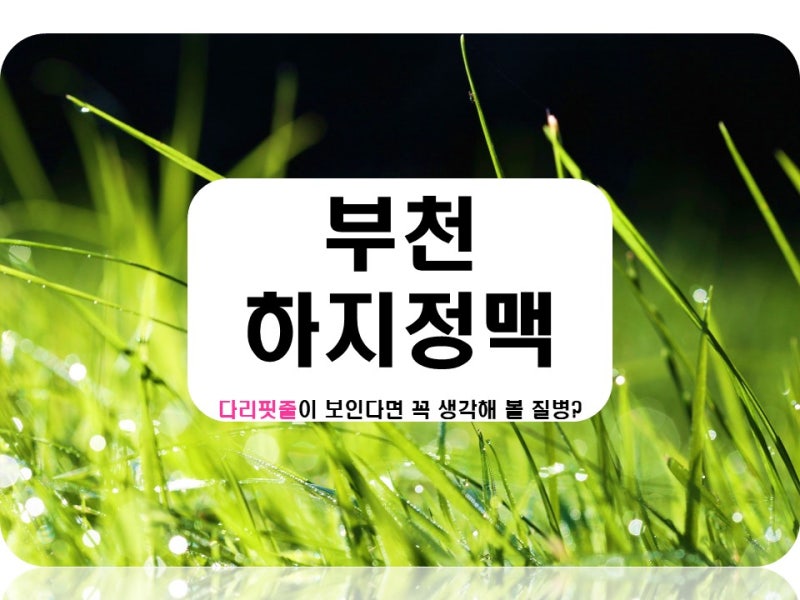 부천하지정맥류, 내게 맞는 치료법 찾아주는 병원으로